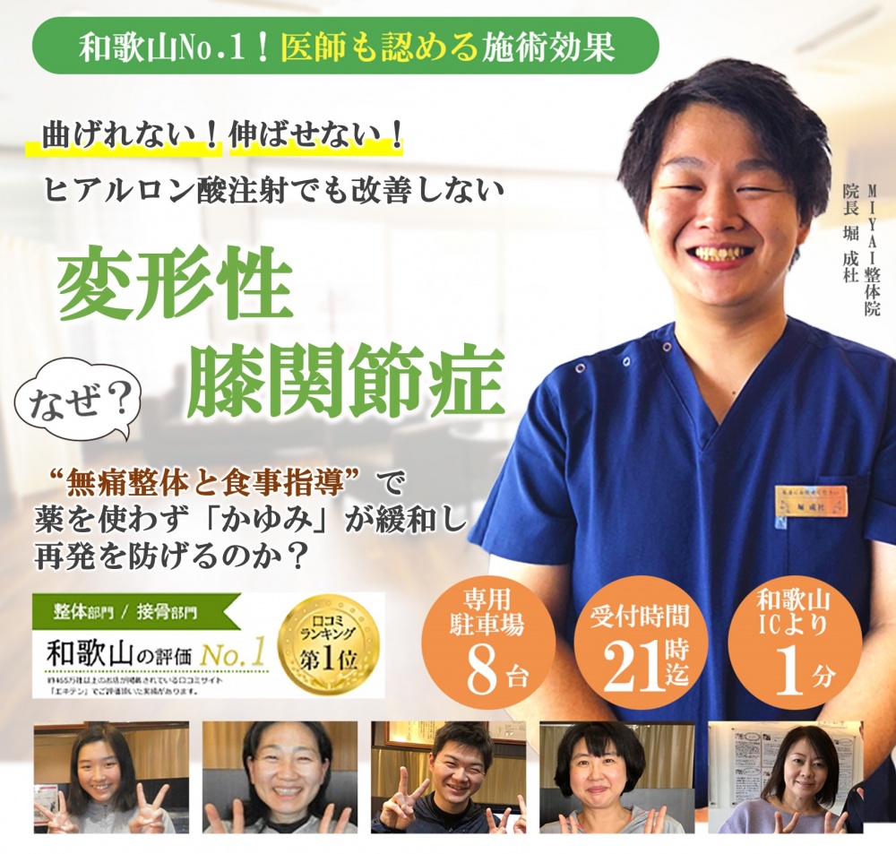 変形性膝関節症のファーストビュー